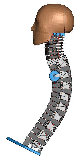 2 Figure 1: Abaqus BioRID-II model (left); spine-head subsystem showing vertebrae (bottom) the neck region to model muscle strength.
