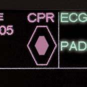 Defibrillator Dashboard will automatically notify clinical engineering if a defibrillator is not ready, and