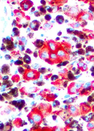 AP and HRP Systems can be used in multiplex IHC staining. Optimized for use with Bio SB Tinto Prediluted antibodies. Kits available in mouse/rabbit configurations.