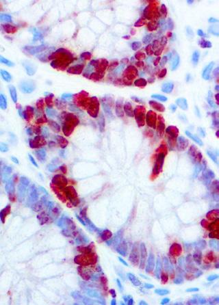 which ensures consistent and reproducible immunostaining in different types of tissues.