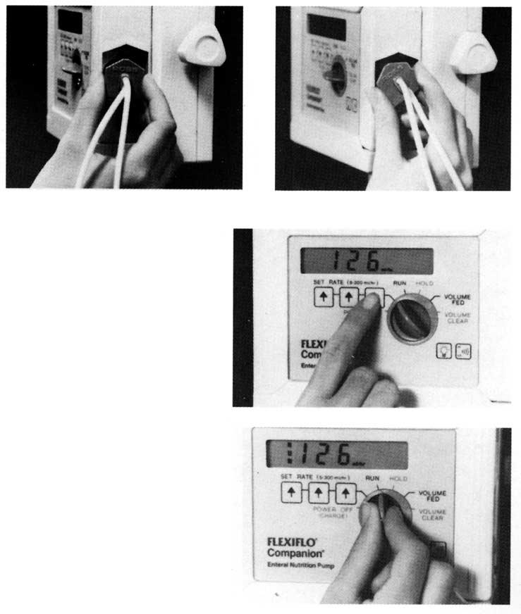 Connect adapter to enteral feeding tube. NOTE: When LOW BATTERY message appears, pump will run for approximately 30 minutes before shutting down completely.