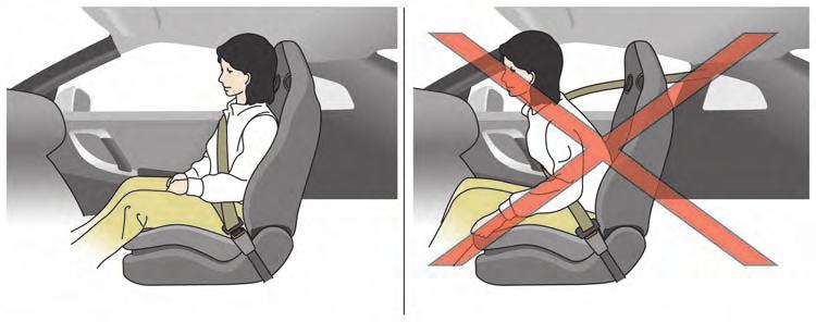 Sit upright and well back. Sit upright and well back. WARNING. The front air bags ordinarily will not inflate in the event of a side impact, rear impact, rollover, or lower severity frontal collision.