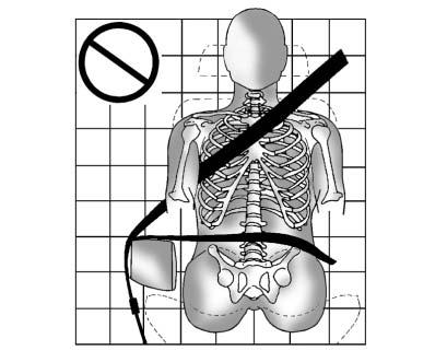 In a crash, the belt would go up over your abdomen. The belt forces would be there, not on the pelvic bones.