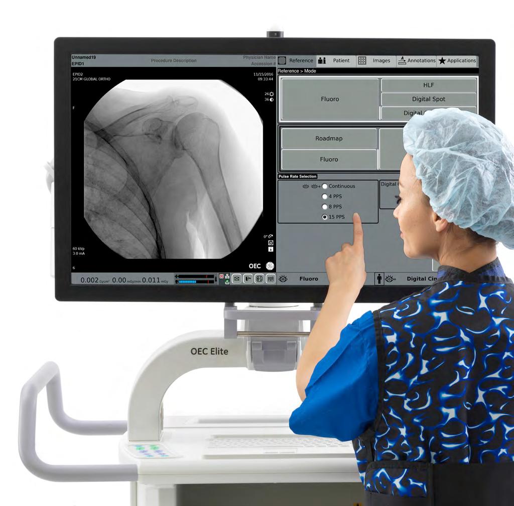 With a broad range of orthopedic, vascular and general surgery controls, OEC Elite CFD gives you the ability to manage dose and image quality independently empowering YOU to choose the optimum