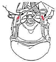 EF- 2000. 22 AIRCREW EXTRACTION-Continued 1. AIRCREW EXTRACTION - Continued h. Disconnect oxygen mask from helmet, by using the left or right bayonet connectors, located at either side of lower mask.