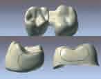 cement space adjustment - coping shape modification - full library of tooth models - fully