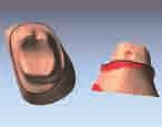 DENTMILL The product of 25 years experience, DentMILL is a CAM software package enabling you to