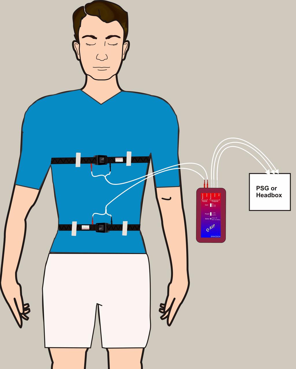 Description The Q-RIP System consists of two respiratory effort belts (0572) and one Q-RIP interface (0571).