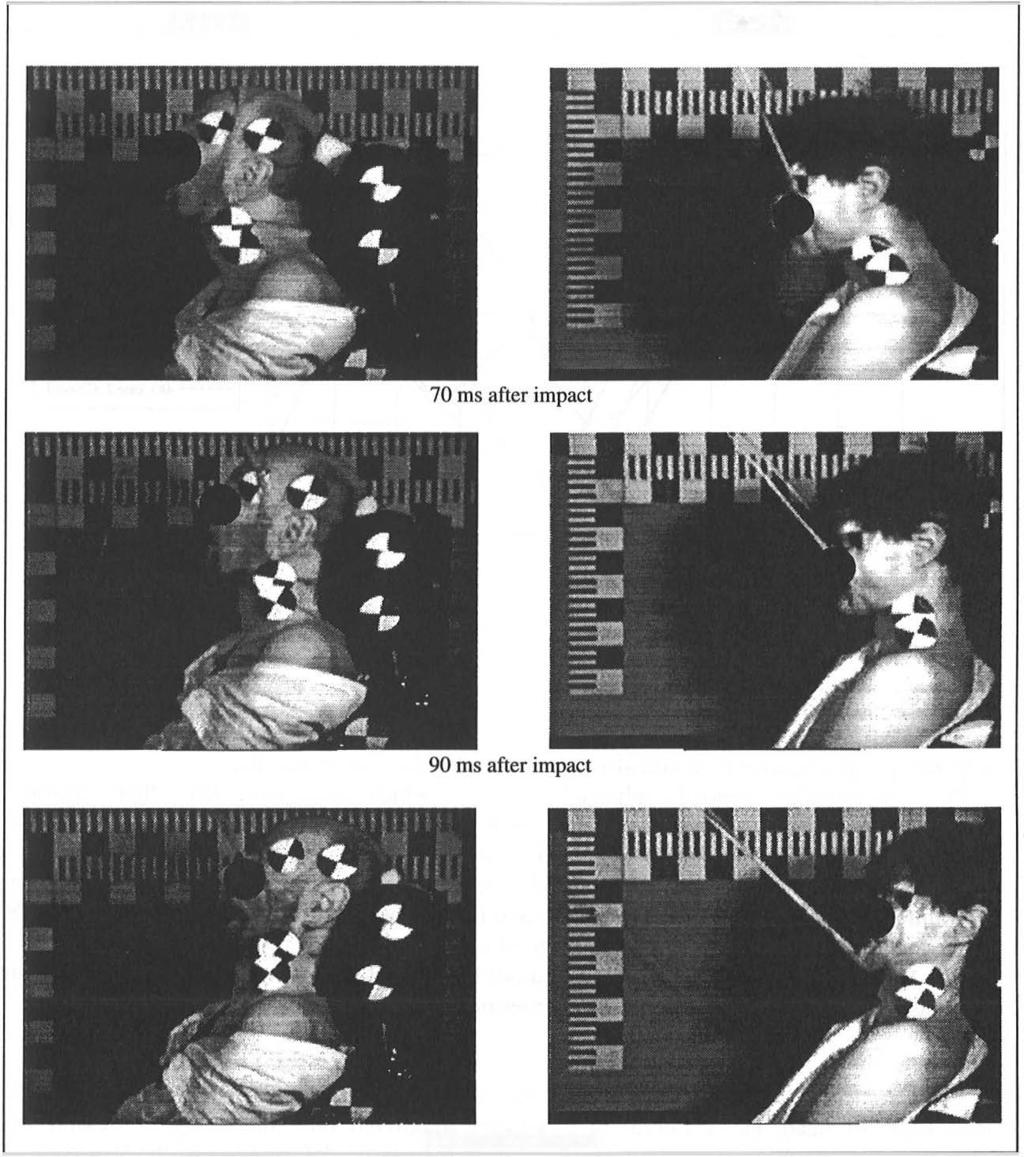 For the lower part of the cervical spine two types of movements can be seen Case Case 2 ms after impact Fig 8 Comparison of different initial seating positions On the left photo, 9 ms after impact,