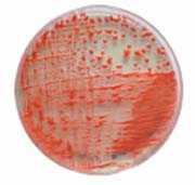 The Yeast Rhodotorula glutinis Means red glutton Aerobic, oleaginous (oil-producing) yeast High methyl ester yield 1,2 Breaks down carbon oxygen demand (COD) in waste streams 2,3 1.