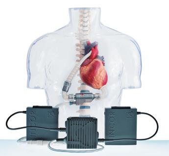 Berlin Heart offers three devices: the implantable INCOR and the external EXCOR Adult for adult patients, and the EXCOR Pediatric, which is the only VAD available and approved for pediatric patients.