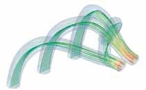Advanced Analysis Linear & Nonlinear The implicit solution technology in Abaqus is ideal for solving static and low-speed dynamic events, such as sealing pressure in a gasket joint or crack