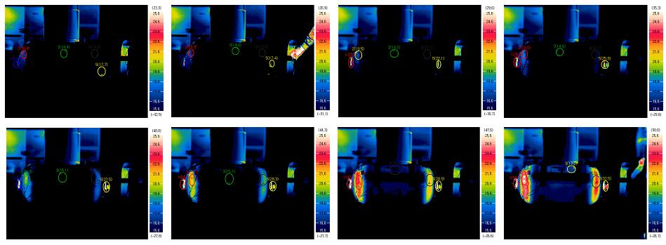 Fig. 7 shows the external temperature distribution on the cylinder surface taken by thermal imaging camera during the hydrogen fuelling process with pressurizing up to 35 MPa.