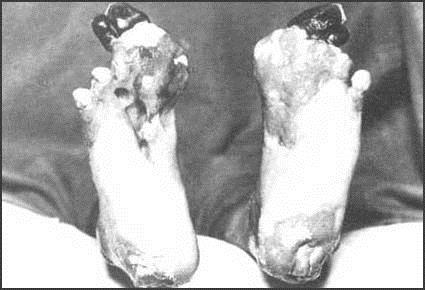 You may not want to see these feet if you have a weak