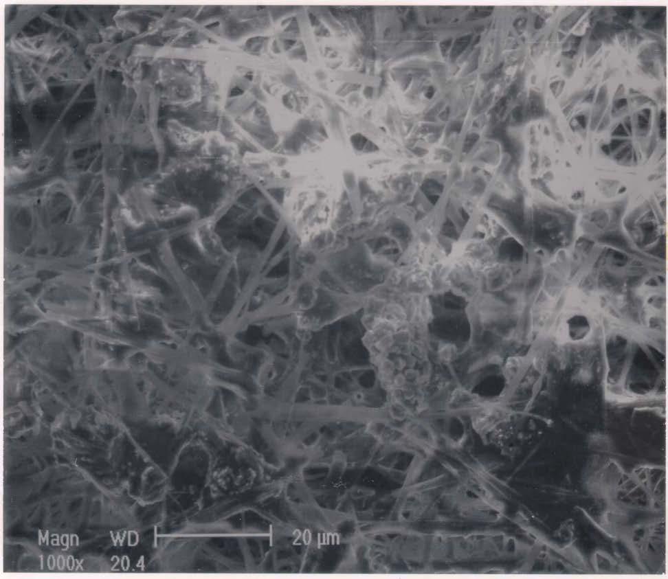 Microbial Growth Scanning Electron Micrograph of Fungus Growth Is at Fuel / Water