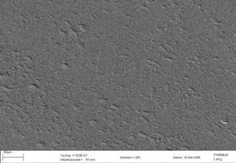 Picture 02: 100 µm high voltage = 10.