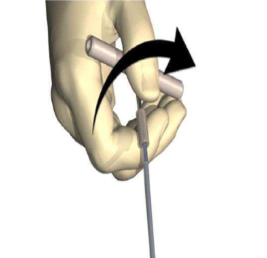 Tunneling the DBS Lead and Extension 1. Create a pocket for the Stimulator under the skin in a location inferior to the clavicle on the same side as the DBS Lead and Extensions.