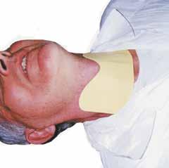 The AttenuRad CT Thyroid shield, when used for the soft tissues of the neck, is cut to a thickness of 1 mm allowing for a 60% dose savings to the Thyroid.