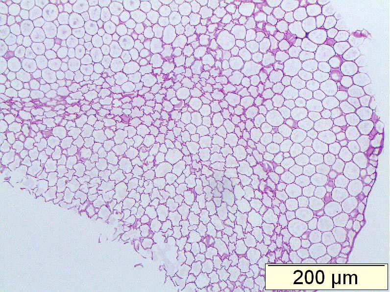 Microscopy (staining with periodic