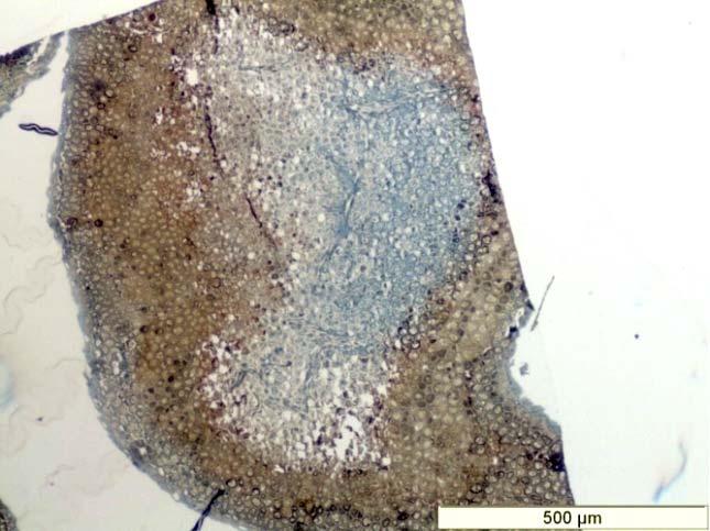 Microscopy (Staining with Sudan