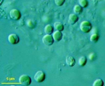 Nannochloropsis Grows in salt water No need for fresh water Requires special equipment High oil content High biomass