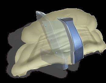 It is possible that they can snap loose (or into many pieces) and become projectile objects in the event of an airbag deployment.