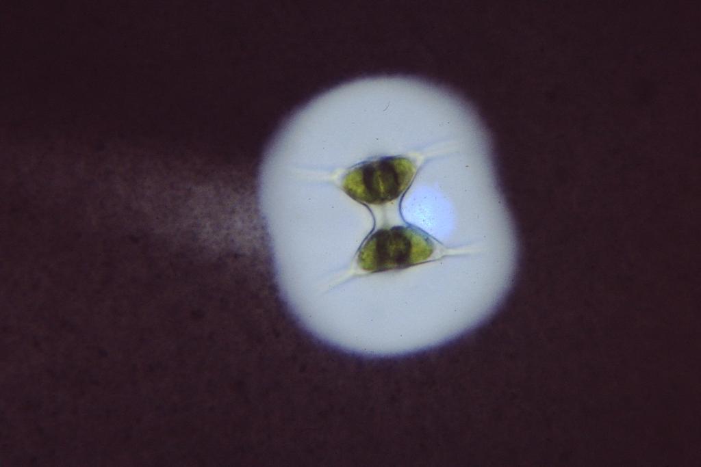 (diatom) Scenedesmus