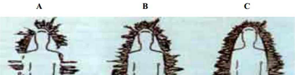 Primeri učinkov sevanja: A - Slika človeške aure z vklopljenim telefonom v žepu, B - Slika človeške aure