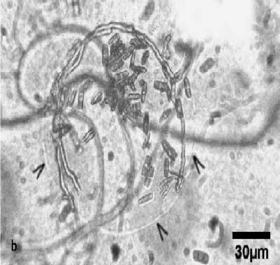 Si, C, P, Fe, Salt etc) Interaction of diatoms, cyanobacteria