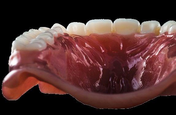 Family of Denture Base Materials The NATURE-CRYL family of denture base materials consists of two High Impact denture materials, (NATURE- CRYL SUPER HI IMPACT and NATURE-CRYL HI-20ET), a self-curing