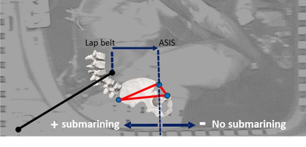 In [13] the submarining distance was defined as the X-axis position of the right ASIS of the pelvis relative to the X-axis position of the lap belt at the midline of the