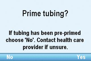 Priming the Tubing and Connecting to Your Catheter When priming the fluid path, the tubing downstream of the pump is filled with fluid, removing any air bubbles.