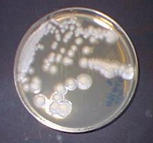 Types of Microbes Found in