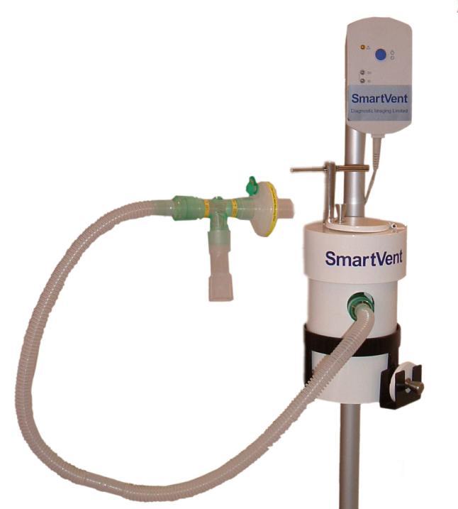 SmartVent Instructions for Use Version 4 (Dec 2009) SmartVent is a radioaerosol delivery system that has been developed to give unrivalled performance for lung ventilation scintigraphy.
