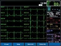OPTIONS 12-LEAD ECG 12-channel ECG visible simultaneously.