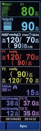 IBP 6 4 5 7 5 6 RESPIRATION Respiratory rate is derivable from different sources EtCO 2