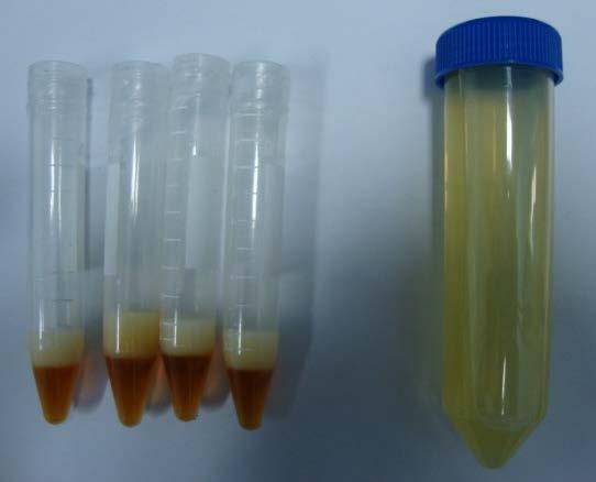 Results The oil from Chlorella protothecoides and small sample of Chlorella vulgaris were converted to biodiesel. properties stage one Stage two Chlorella vulgaris (Lee et al.