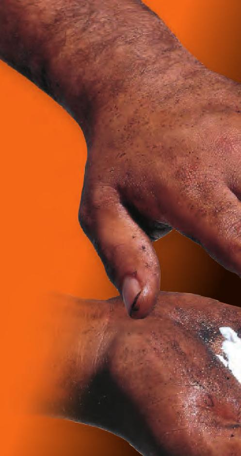 Wherever hands are getting dirty, there s a place for Permatex hand cleaners.